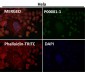 Anti-p53 (acetyl K370) TP53 Rabbit Monoclonal Antibody